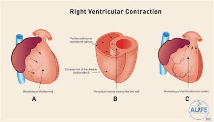 What causes increased ventricular contraction?